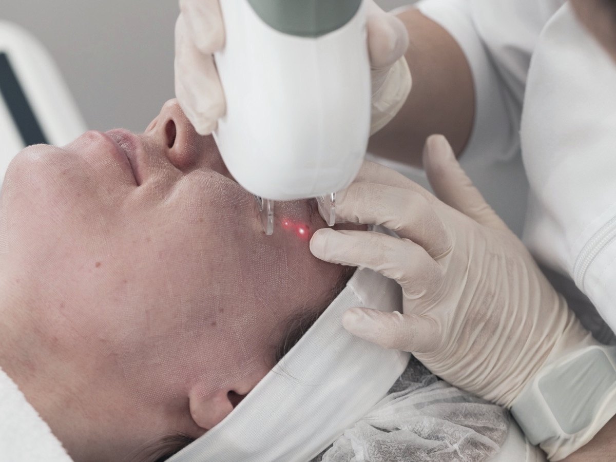 Laser & skin resurfacing