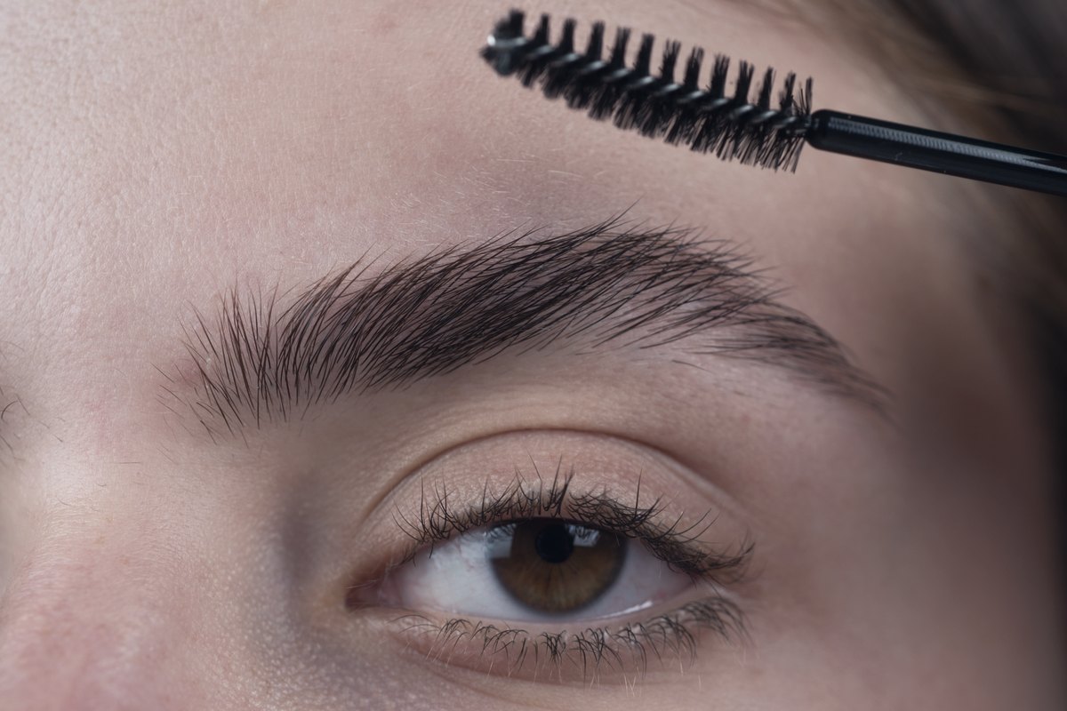 Brow lift surgery