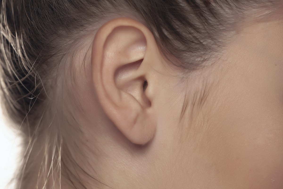 Ear pinning / reshaping
